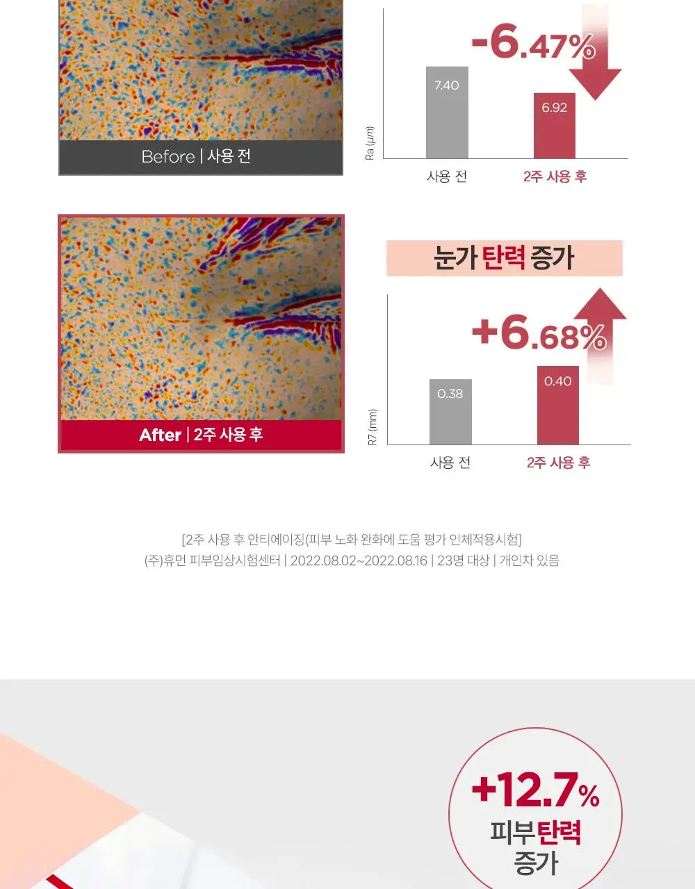 [1매] 더마토리 밀착 밴드 마스크 3종 택1 (징크/레티날/히알샷) 상세페이지 22